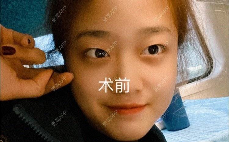 更美 - 心情就像花开花落的眼部多项经验 | 南昌 | 眼部多项