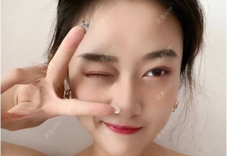 更美 - 心情就像花开花落的眼部多项经验 | 南昌 | 眼部多项