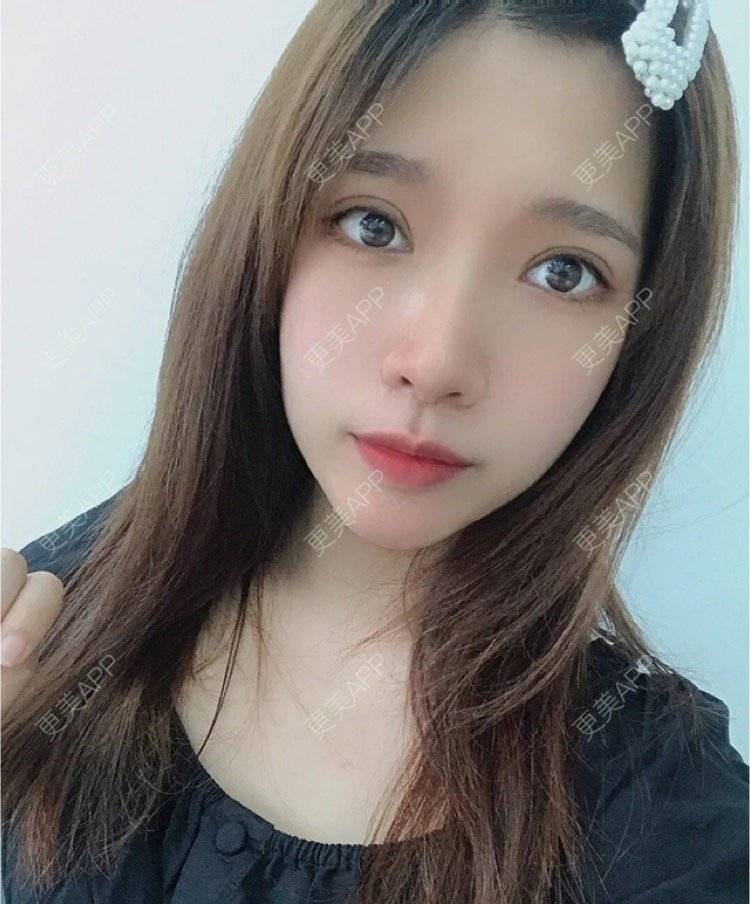 更美 - 心情就像花开花落的眼部多项经验 | 南昌 | 眼部多项