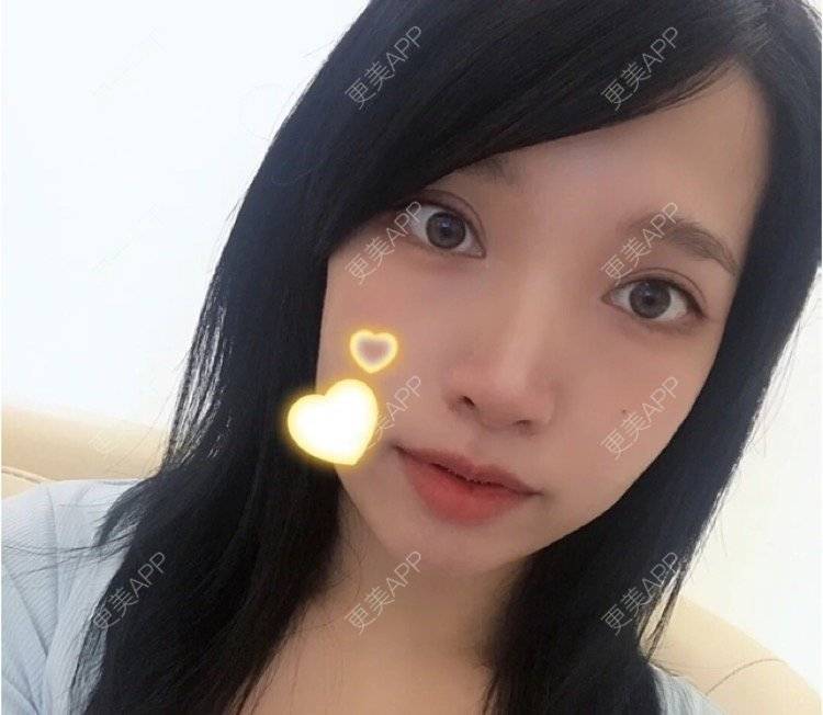 更美 - 心情就像花开花落的眼部多项经验 | 南昌 | 眼部多项