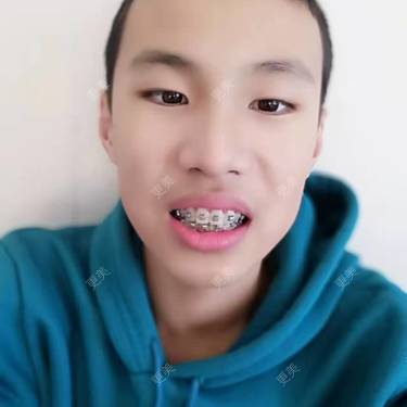 赵鹏 医生