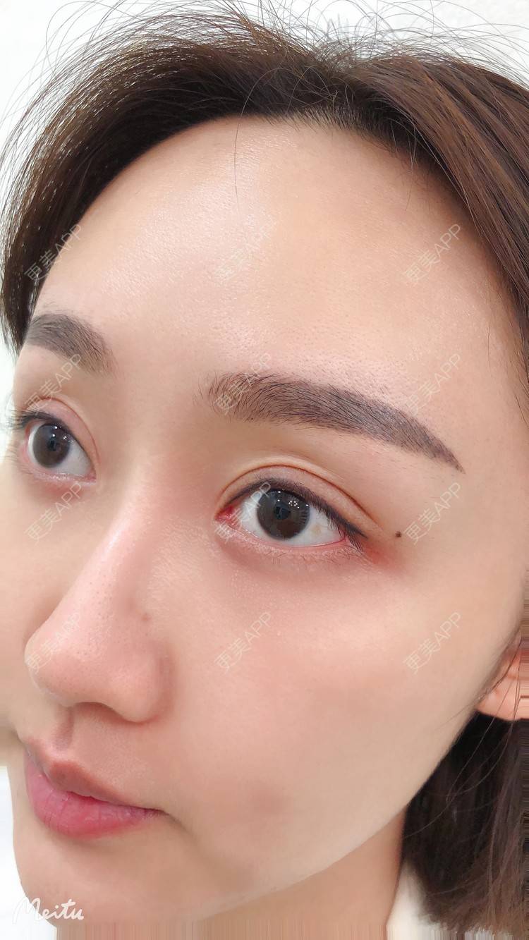 更美 - 吴华 医生的半永久纹眉经验 | 半永久纹眉