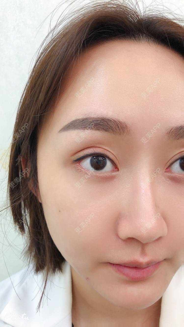 更美 - 吴华 医生的半永久纹眉经验 | 半永久纹眉