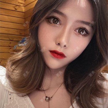 李晨阳 医生