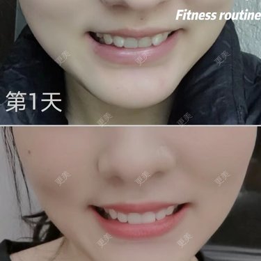 李晨阳 医生