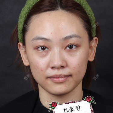 李晨阳 医生