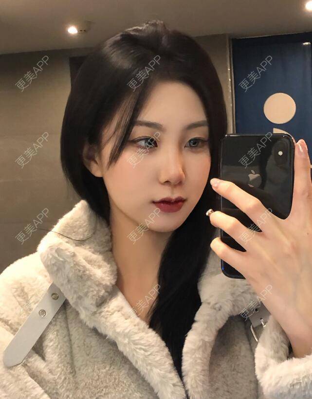 更美 - 张瀚博 医生的玻尿酸经验 | 玻尿酸