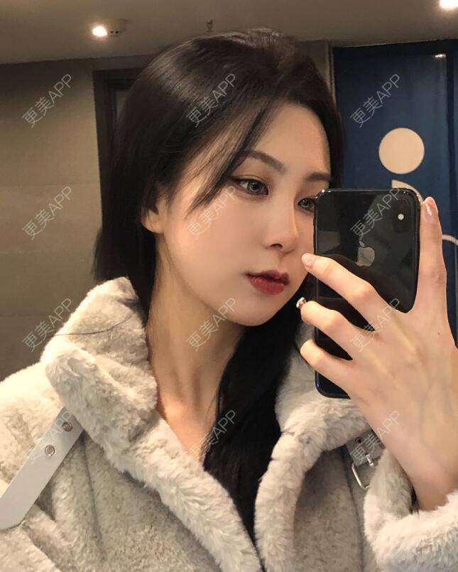 更美 - 张瀚博 医生的玻尿酸经验 | 玻尿酸