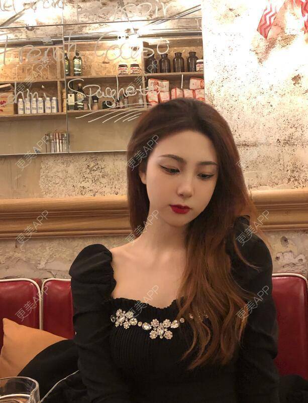 更美 - 张瀚博 医生的玻尿酸经验 | 玻尿酸