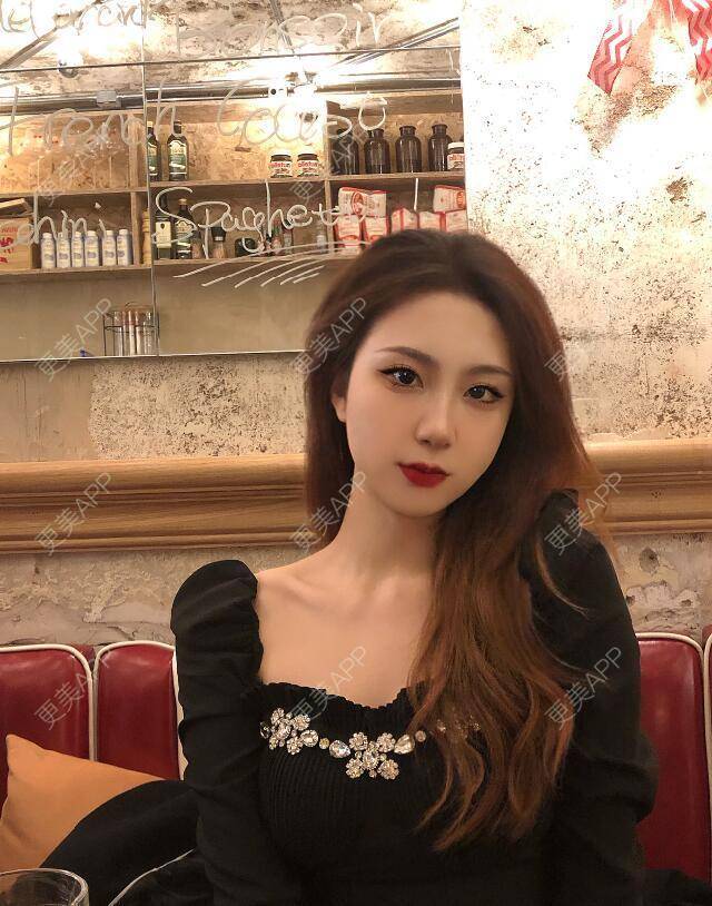 更美 - 张瀚博 医生的玻尿酸经验 | 玻尿酸