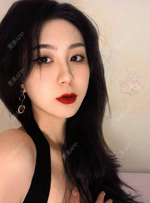 更美 - 张瀚博 医生的玻尿酸经验 | 玻尿酸