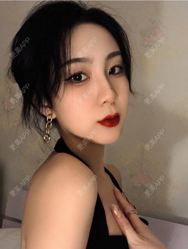 更美 - 张瀚博 医生的玻尿酸经验 | 玻尿酸