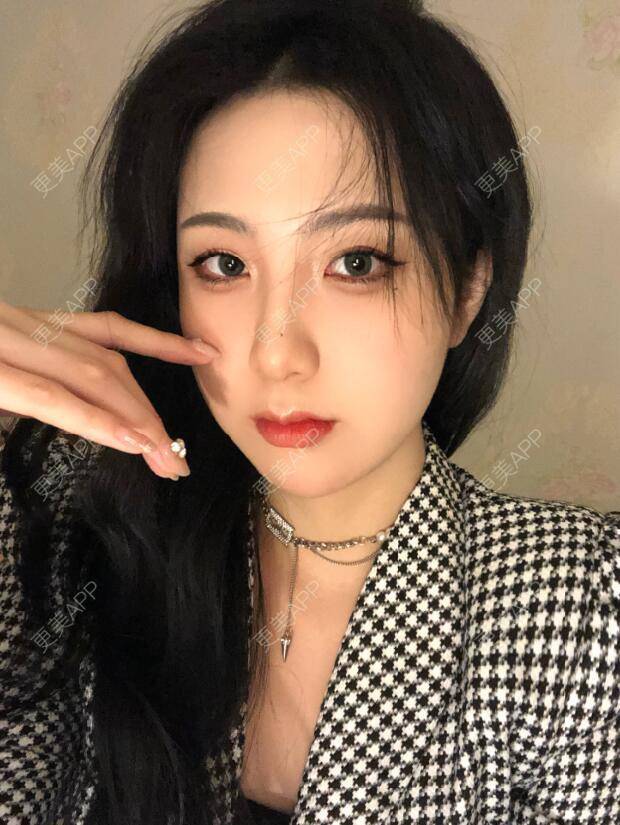 更美 - 张瀚博 医生的玻尿酸经验 | 玻尿酸