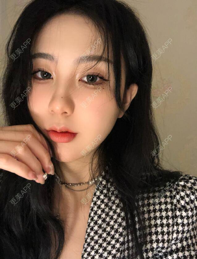 更美 - 张瀚博 医生的玻尿酸经验 | 玻尿酸