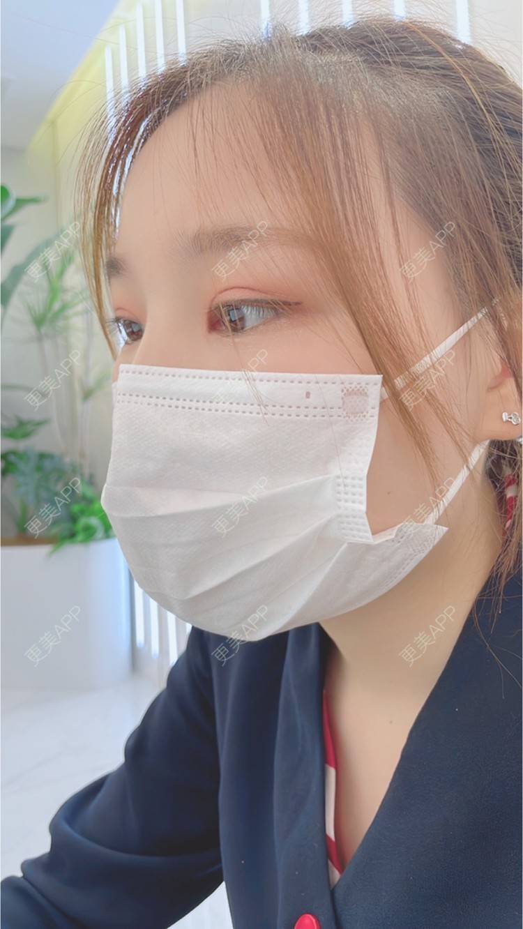 更美 - 成都青羊栖羽医疗美容门诊部的眼部多项经验 | 成都 | 眼部多项