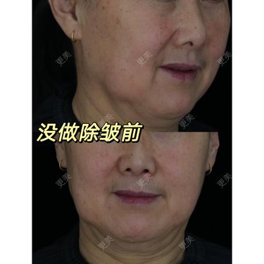 吴华 医生