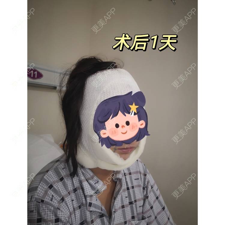 更美 - 吴华 医生的SMAS除皱手术经验 | 除皱套餐 | SMAS除皱手术