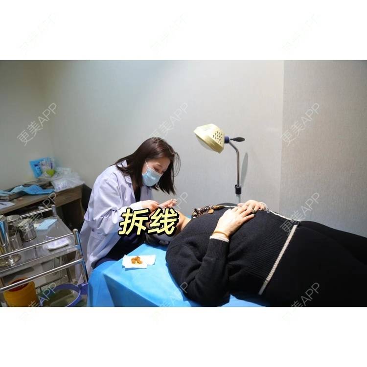 更美 - 吴华 医生的SMAS除皱手术经验 | 除皱套餐 | SMAS除皱手术