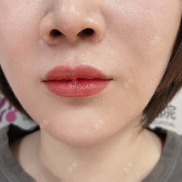 张雪莹 医生