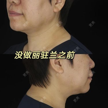 吴华 医生
