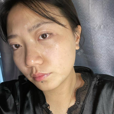 2818588977精细自然 66 上海￥2999#鼻综合#眼综合#上海真的是佩服