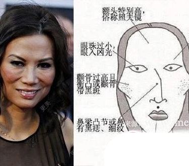 颧骨颧弓